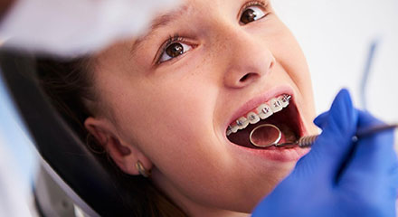 img-newsmile-treatment-braces-howwork-treatmentplan