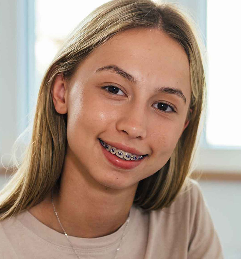 img-newsmile-treatment-bracesforadults-benifits