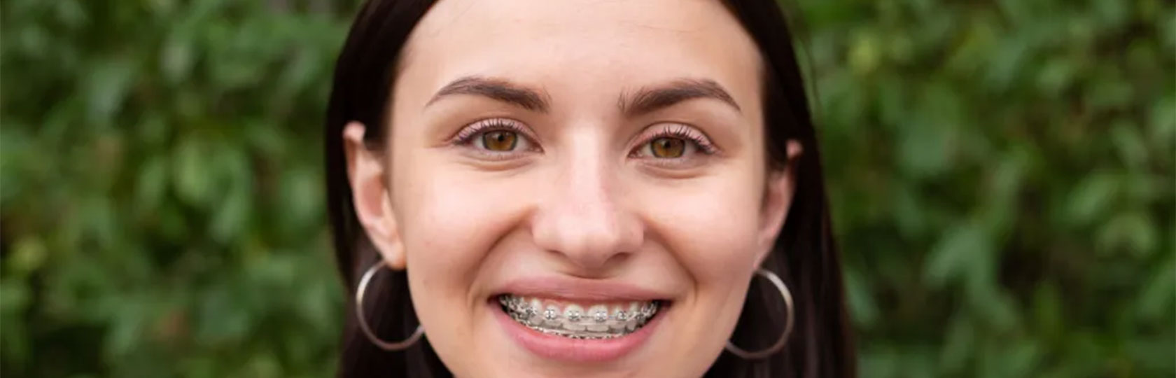 img-homechawlaorthodontics-orthodontics-header