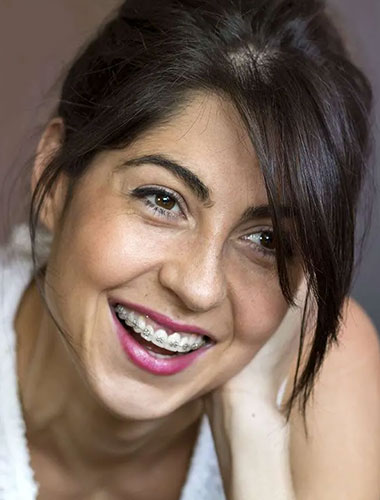 img-newsmile-treatment-bracesforadults-whatisbraces