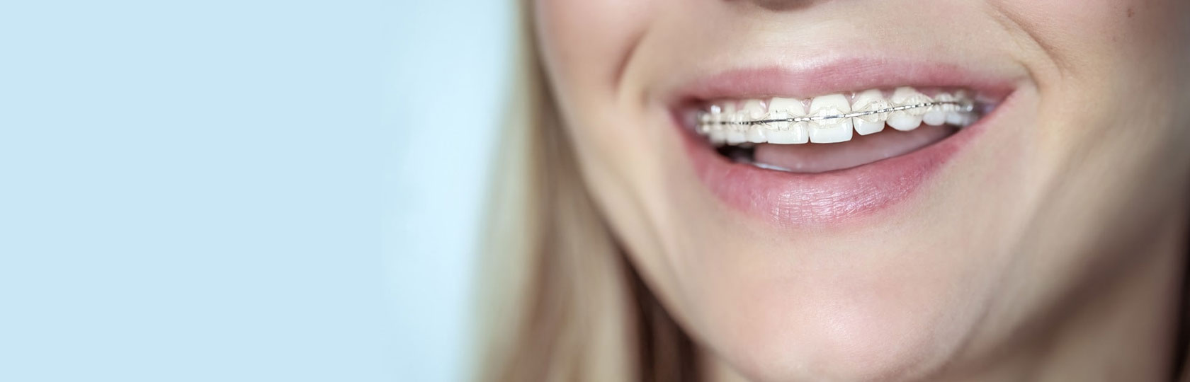 img-homechawlaorthodontics-orthodontics-header