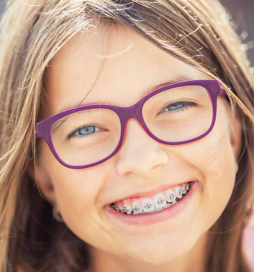 img-newsmile-treatment-traditionalbraces-benifits