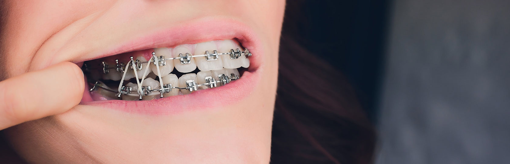 img-homechawlaorthodontics-orthodontics-header