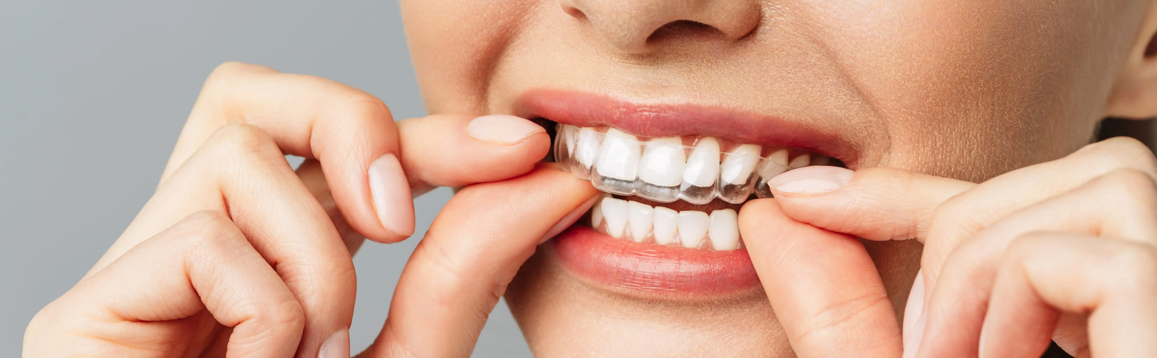 img-homechawlaorthodontics-orthodontics-header