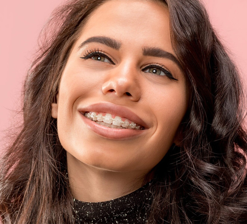 Benefits of Clear Braces