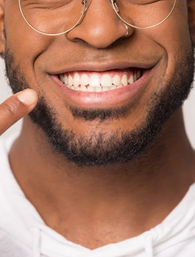 img-teethwhitening-01