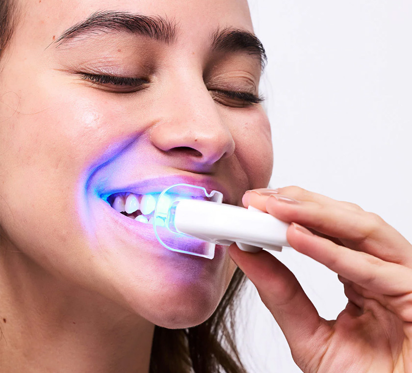 img-teethwhitening-02