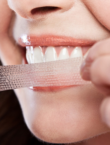 img-teethwhitening-03