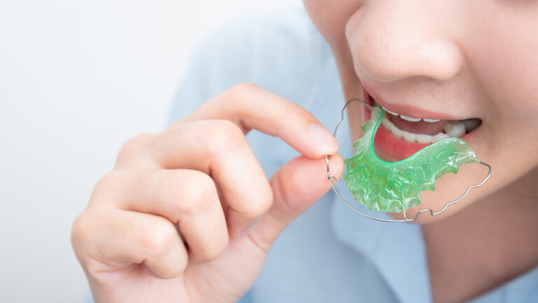 Hawley retainer
