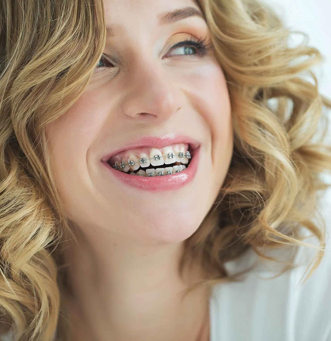 img-newsmileortho-adultorthodontics