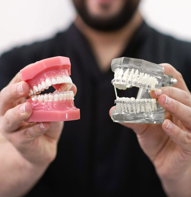 img-newsmileortho-featured-01